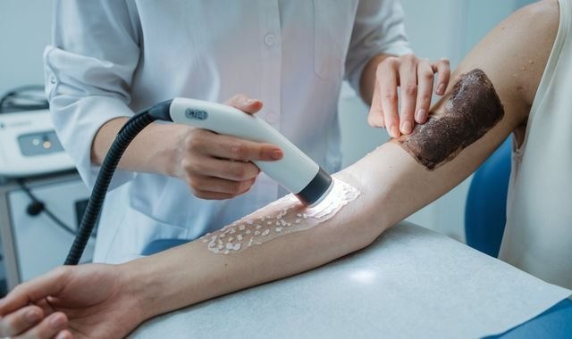 Safed Daag Ka Ilaj: Oldforest Ayurved Ki Jadid Dawa